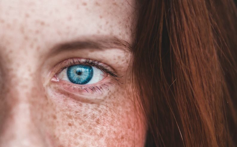 partie du visage d'une femme sur laquelle on aperçoit un oeil bleu et des poches sous les yeux