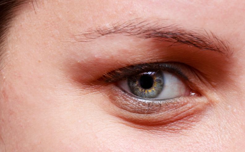 Zoom brut sur des cernes