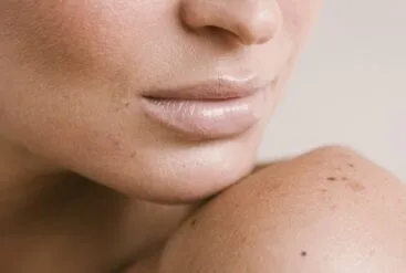 Un zoom brut sur la peau d'une jeune femme