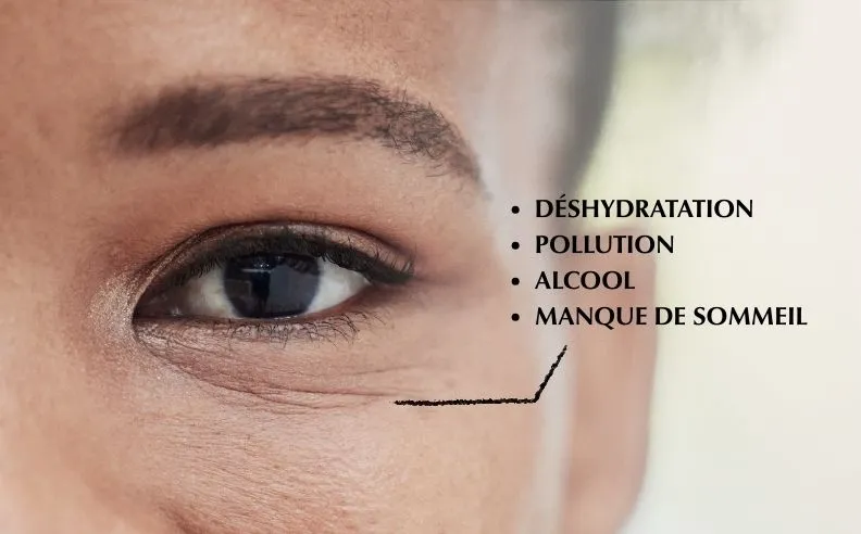 Zoom sur un œil avec les sources clé néfastes pour le contour des yeux
