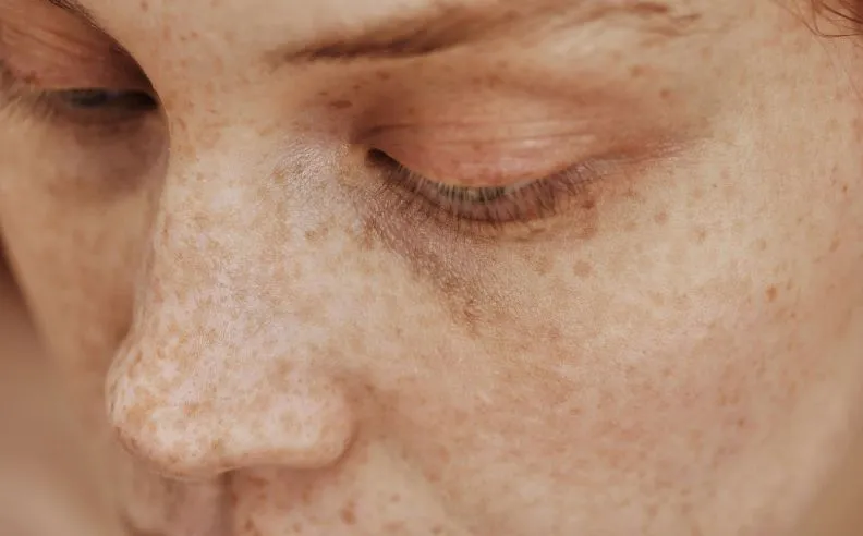 Zoom brut sur des cernes