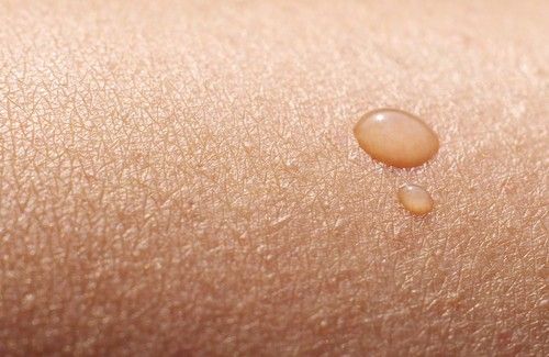 Comment reconnaître les symptômes d’une peau déshydratée et comment en prendre soin ?