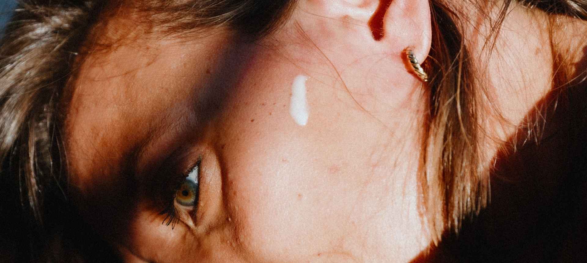 Sensibilité, rougeurs