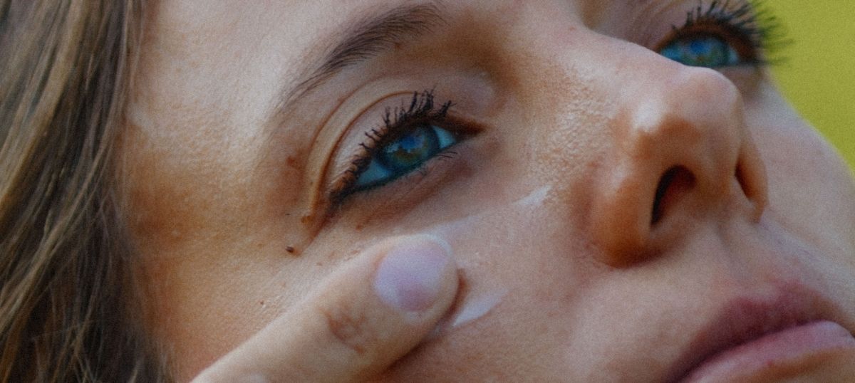 Peau à imperfections